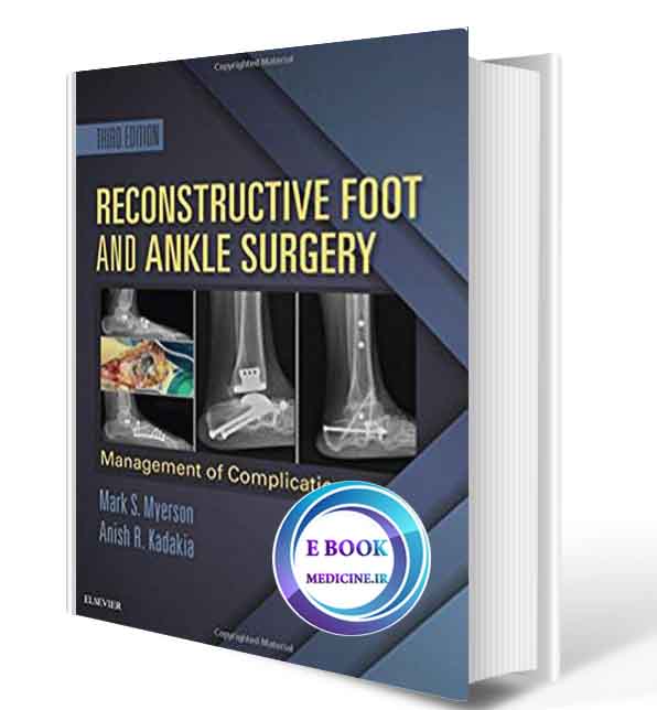 دانلود کتاب Reconstructive Foot and Ankle Surgery: Management of Complications2019( PDF)